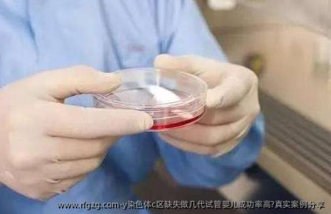 y染色体c区缺失做几代代孕成功率高?真实案例分享