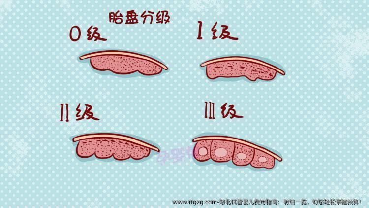 湖北代孕费用指南：明细一览，助您轻松掌握预算！