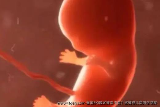泰国EKI做试管贵不贵？代孕费用全掌握