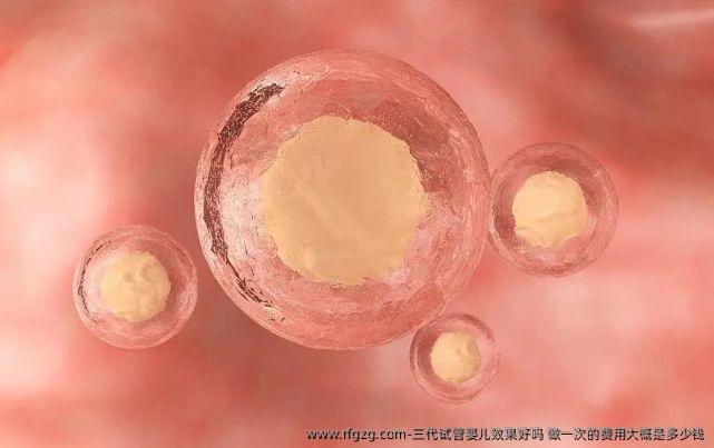 三代代孕效果好吗 做一次的费用大概是多少钱